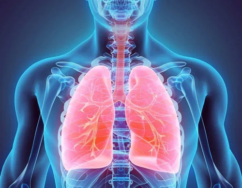 Empyema Treatment by Expert London Thoracic Surgeon